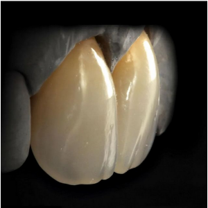 Ceramica